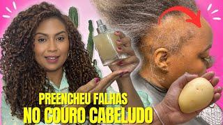 O CABELO CRESCE LOUCAMENTE E NÃO CAI! APENAS 1 BATATA O REMÉDIO MAIS FORTE