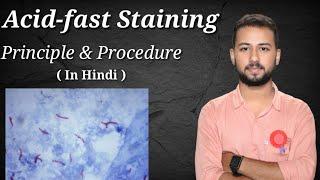 Acid fast staining procedure and principle in Hindi | Ziehl Neelsen (Acid Fast) staining procedure