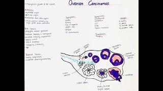 Ovarian Carcinomas - Histology, Types, Symptoms, Diagnosis, Risk Factors, Treatment, Prognosis