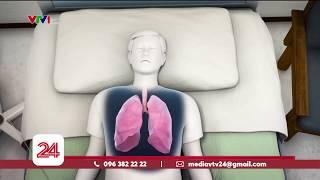 Đã có bệnh nhân tử vong vì virus viêm phổi mới tại Trung Quốc | VTV24