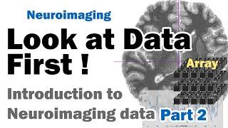 Look at Data First: Introduction to MRI Neuroimaging Data for Neuroscience | part 2