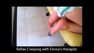 Vojta Therapy with Emma