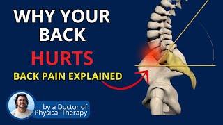 Back Pain from Spondy, Sciatica, Stenosis | Causes & Pain Fix