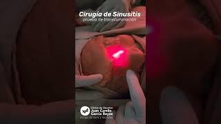 CIRUGÍA DE SINUSITIS