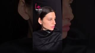 Hollywood face #recommended #рек #top #beauty #aesthetic #lifting #lips #botox #jawline #skincare