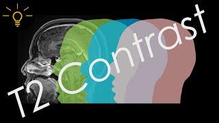 MRI T2 Contrast EXPLAINED | MRI Physics Course Lecture 5