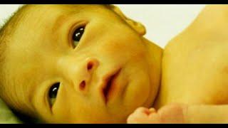 Neonatal direct hyperbilirubinemia Idiopathic neonatal hepatitis and biliary atresia by Dr Saif Al K