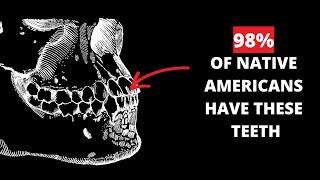 What your teeth say about your ancestry