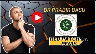 Red patch on Penis  - explained in Bengali