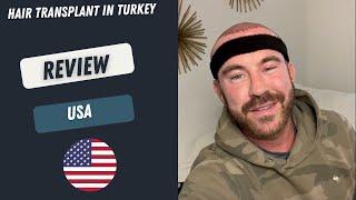 Hair Transplant in Turkey l Patient's Review l Worbimed Clinic