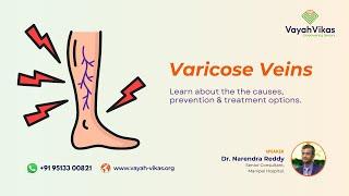 Understanding Varicose Veins in Seniors | Webinar with Dr. Narendra Kumar Reddy | Vayah Vikas