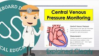 Central Venous Pressure (CVP) Monitoring and Measurement Basics