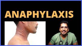 Anaphylaxis! (Causes, Clinical features, Management)