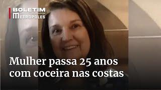 Mulher passa 25 anos com coceira persistente até descobrir diagnóstico | Boletim Metrópoles 2º