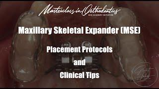 Maxillary Skeletal Expander | MSE | Jaw Expansion | Placement Procedure | Clinical Protocol and Tips