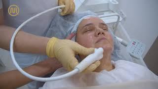 RF-лифтинг Venus Viva в NICA MEDICA