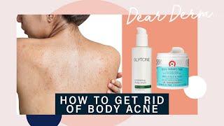 How to Get Rid of Body Acne | Dear Derm | Well+Good