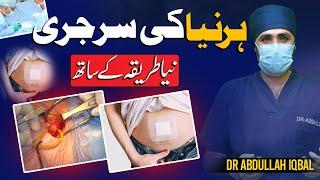 Hernia Surgery or Hernia Operation in Urdu | Hernia Surgery With Local Anesthesia