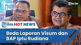 Muncul Lagi Kejanggalan Hasil Visum dan Laporan Iptu Rudiana soal Penyebab Kematian Vina dan Eky