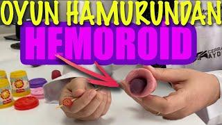 LAZER Mİ? KLASİK Mİ? HANGİ HEMOROİD AMELİYATI ACISIZ?