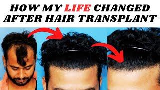 MY STORY AFTER HAIR TRANSPLANT OF 2800 GRAFTS || BEST HAIR TRANSPLANT IN JAIPUR @Tannudada