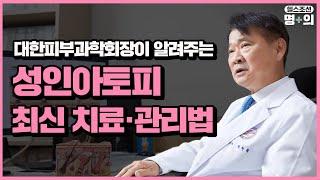 [성인아토피 명의] "‘치료 무기’ 다양해져… 포기 말아야"