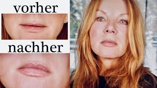 Lift your Lips Tutorial * Volle Lippen ohne Aufspritzen * Kirsty Coco