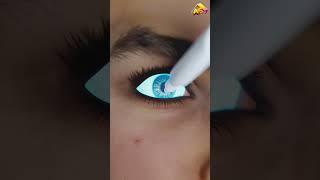 Removing Stuck Contact Lenses  3D Animation #3d #hindi #3danimation