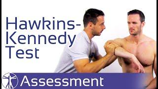 Hawkins-Kennedy Test | Subacromial Pain Syndrome (SAPS)