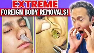 Doctor Reacts to EXTREME & SATISFYING Foreign Body Removals!