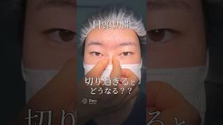 【二重整形/目頭切開】ご希望に合わせて施術いたします！#shorts