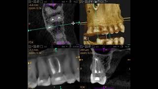 CBCT software trick view #1