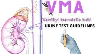 VMA Detection // Urine Test//it's simple //MLTTUTELAGE/Requested topic.