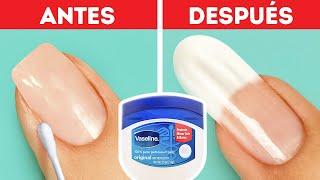 SOLUCIONES RÁPIDAS PARA PROBLEMAS DE BELLEZA