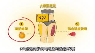 今天抽脂瘦大腿明天可以上班你相信嗎？