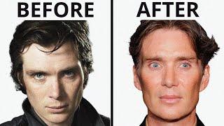 Cillian Murphy: All Natural? | Plastic Surgery Analysis