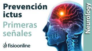 Cómo sospechar en 30 segundos de un ictus o accidente vascular cerebral ACV