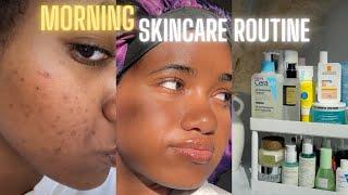 My Morning Skincare Routine for Glowing Skin | (unsponsored) Clearing my hormonal acne