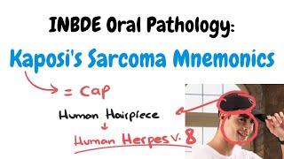 Oral Pathology | Kaposi's Sarcoma Mnemonics | INBDE