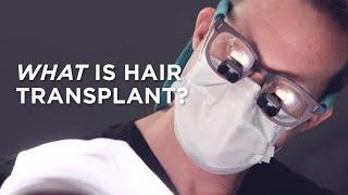 Hair Transplant Explained by Dr. Alan Bauman