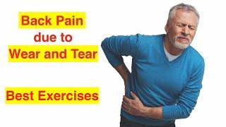 Back Pain due to Wear and Tear/Arthritis