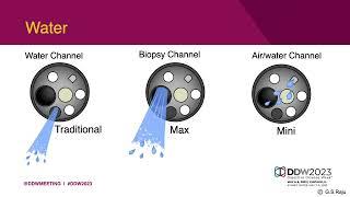 DDW 2023 Incomplete Colonoscopy