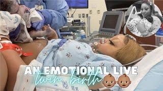 THE LIVE BIRTH OF OUR SECOND SET OF TWINS | *Real, Raw & Emotional* Doctor Turns Breech Baby in Womb