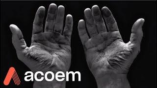 Shaft Alignment: The Power is in Your Hands | ACOEM