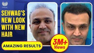 Virender Sehwag's Hair Transplant Results | Cricketer/Celebrity Hair Transplant In India