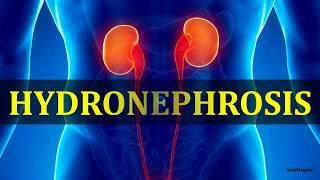 HYDRONEPHROSIS