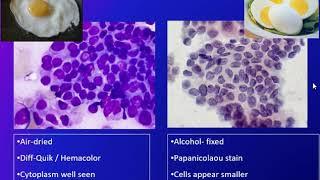 Principles of FNA (lab perspective) pt  2