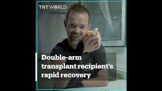 Double-arm transplant recipient’s unexpectedly rapid progress