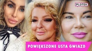 NASZE TOP 10 - powiększone usta gwiazd