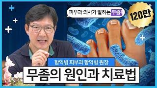 무좀의 원인, 치료, 예방(함익병 피부과 함익병 원장)